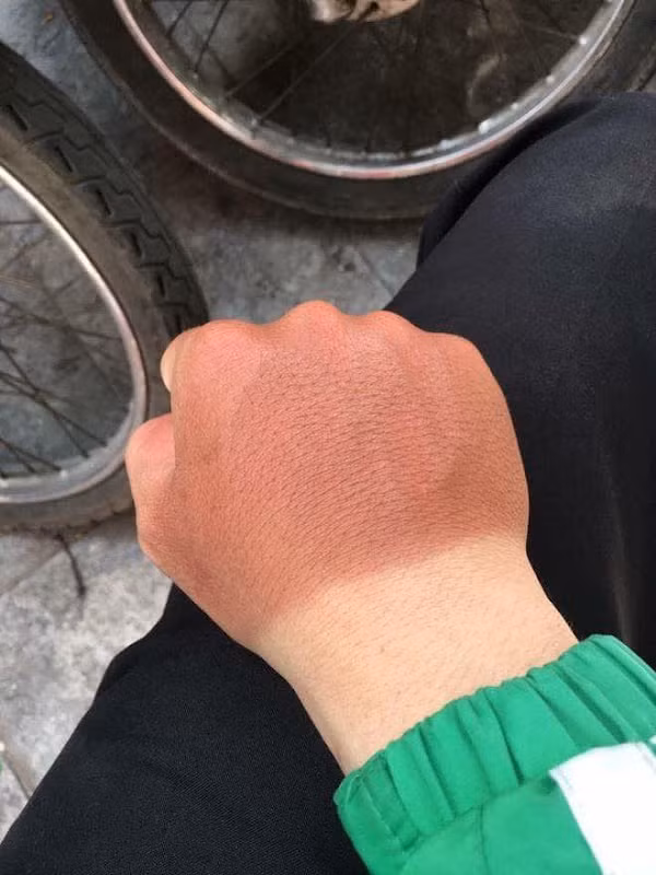 Kể cả có che chắn kỹ lưỡng cỡ nào thì vẫn có những chỗ không thể che tới và đó chính là mục tiêu “ tấn công” của nắng.