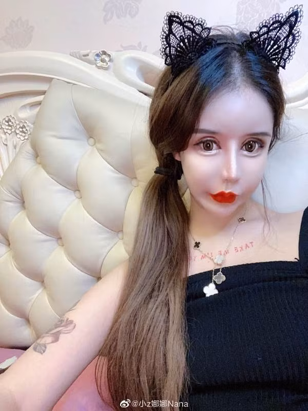 Trong chương trình này, Na Na cho biết vì bị miệt thị ngoại hình mà cô phải quyết tâm thẩm mỹ thay đổi dù hứng chịu nhiều hậu quả.