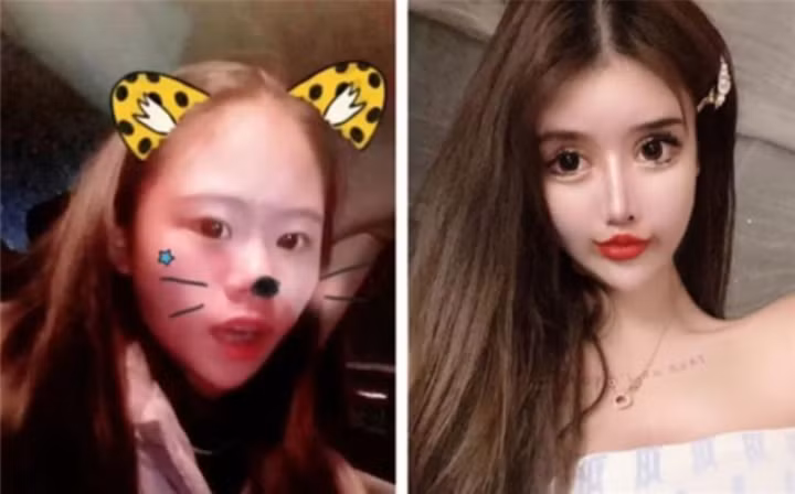 Cô gái này cho biết cô đã chi ra 4 triệu nhân dân tệ (hơn 14 tỷ VND) dành cho việc phẫu thuật thẩm mỹ, phần lớn tiền đều đến từ cha mẹ.