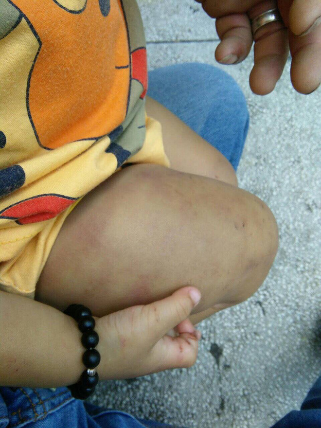 Bao hanh con tham te, khong the tin noi ho la bo me nan nhan-Hinh-9