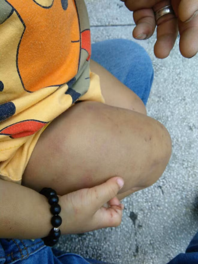 Bao hanh con tham te, khong the tin noi ho la bo me nan nhan-Hinh-9