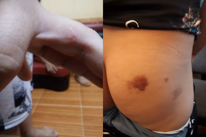 Bao hanh con tham te, khong the tin noi ho la bo me nan nhan-Hinh-3