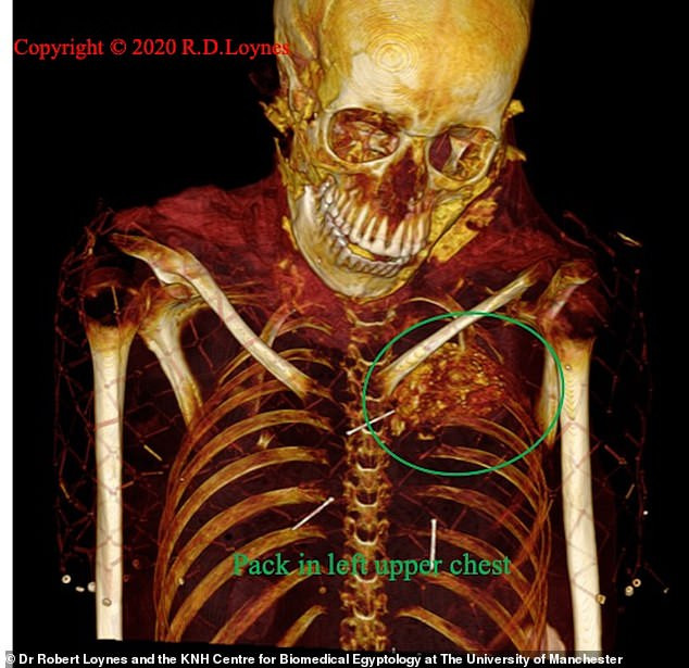 Nguyên nhân tử vong của Takabuti là một bí ẩn lớn đánh đố giới chuyên gia trong suốt nhiều thập kỷ qua kể từ khi xác ướp của bà được đưa đến Ireland năm 1834.