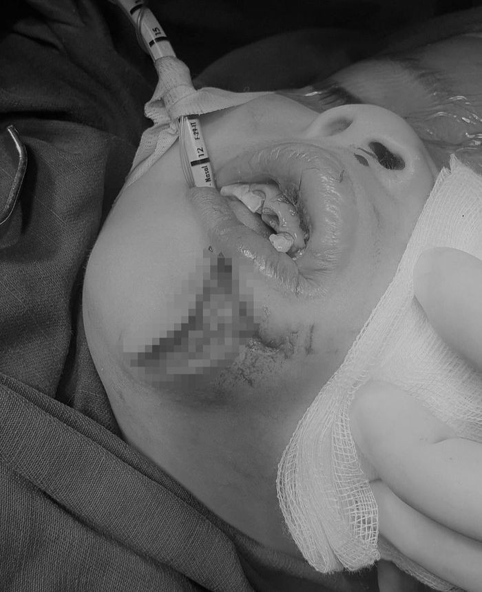 Be trai 4 tuoi bi cho can rach cam