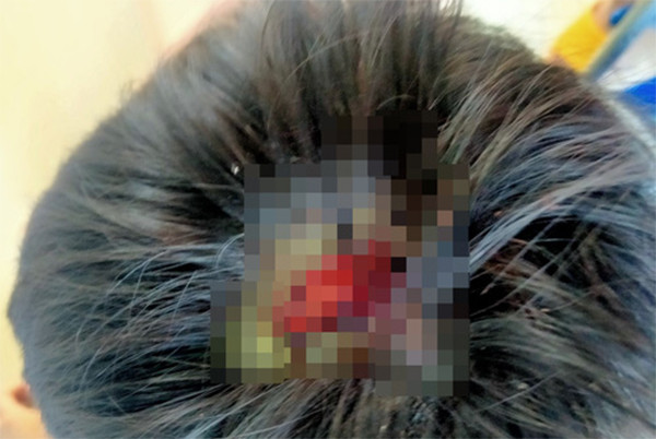  Cha bạo hành, đánh con chảy máu đầu: Đầu tháng 4/2021, khi thấy kết quả thi học kỳ I con trai là cháu Trần Việt B. (9 tuổi) thấp nên Trần Văn Hợi (37 tuổi, trú huyện Chư Prông, tỉnh Gia Lai) lấy cây tre đánh cháu B. dã man khiến cháu B. tổn hại 15% sức khỏe. Sau đó, Hợi bị Công an bắt tạm giam. 