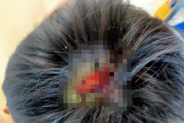  Cha bạo hành, đánh con chảy máu đầu: Đầu tháng 4/2021, khi thấy kết quả thi học kỳ I con trai là cháu Trần Việt B. (9 tuổi) thấp nên Trần Văn Hợi (37 tuổi, trú huyện Chư Prông, tỉnh Gia Lai) lấy cây tre đánh cháu B. dã man khiến cháu B. tổn hại 15% sức khỏe. Sau đó, Hợi bị Công an bắt tạm giam. 