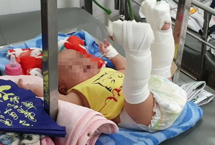  Cha bạo hành con 4 tháng tuổi ở TP.HCM: Ngày 3/2, cháu K. khóc lớn khi nằm võng. Dỗ dành và cho uống sữa nhưng cháu bé không nín, Châu Minh Tiến (24 tuổi, ngụ quận 9, TP HCM) đã tát vào má và đánh vào mông K. Trong cơn giận dữ, Tiến đưa mạnh võng rồi ngưng đột ngột khiến K. rơi xuống đất và bị ngất. Cháu K. bị thương tích 37 %. Ngày 11/2, Tiến bị Công an bắt tạm giam. 