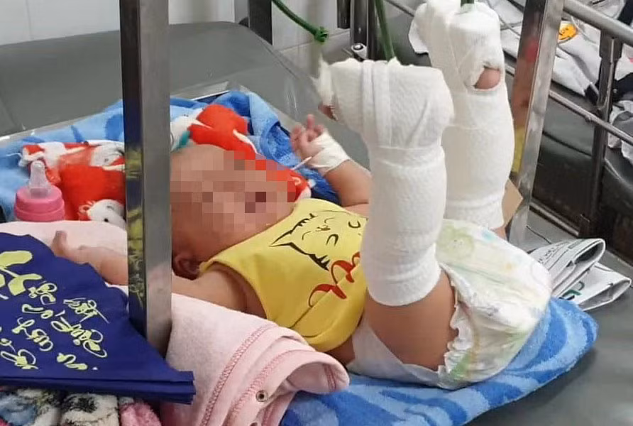  Cha bạo hành con 4 tháng tuổi ở TP.HCM: Ngày 3/2, cháu K. khóc lớn khi nằm võng. Dỗ dành và cho uống sữa nhưng cháu bé không nín, Châu Minh Tiến (24 tuổi, ngụ quận 9, TP HCM) đã tát vào má và đánh vào mông K. Trong cơn giận dữ, Tiến đưa mạnh võng rồi ngưng đột ngột khiến K. rơi xuống đất và bị ngất. Cháu K. bị thương tích 37 %. Ngày 11/2, Tiến bị Công an bắt tạm giam. 