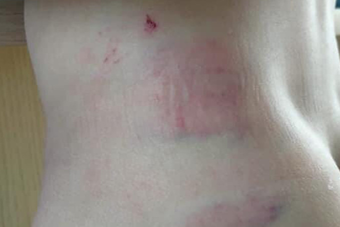  Bé trai 9 tuổi bị cha bạo hành: Ngày 9/1, hàng xóm thấy Trần Việt Boy (9 tuổi ở huyện Chư Prông, Gia Lai) bị đánh nên đề nghị chuyển cháu tới bệnh viện, song ông Trần Văn Hợi (37 tuổi) - cha của Boy không chấp nhận. Sau đó, chị Bế Thị Loan (38 tuổi, mẹ cháu Boy) đưa con trai lên Bệnh viện chữa trị với nhiều vết thương. Sự việc được chị Loan trình báo Công an. Nguyên nhân là do cháu Boy quá lì lợm, không nghe lời bố mẹ. 