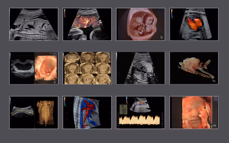 BV Hong Ngoc dau tu thiet bi y te hien dai cho co so moi tai My Dinh-Hinh-3