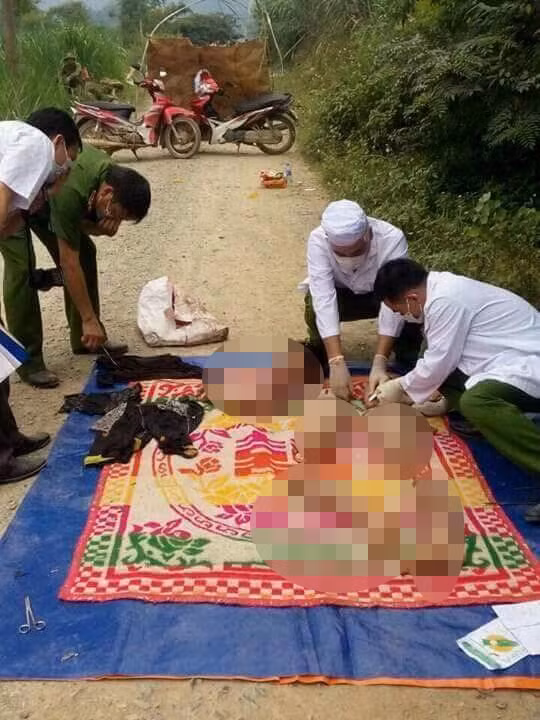 Cao Bang Nam thanh nien bi chat xac mat mot phan thi the