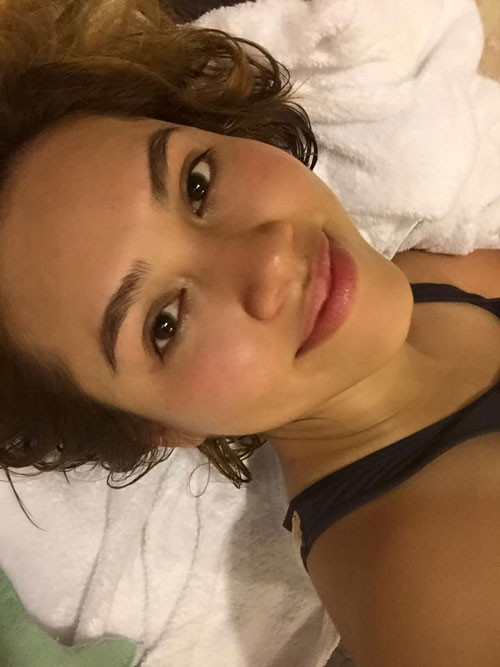 A hau Hoang My bat mi cach tri mun “mot phat an ngay”