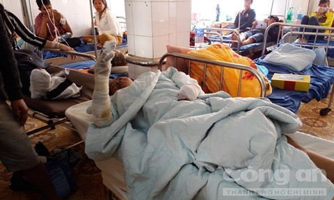 Thuong tam be trai 13 thang tuoi chay nhu duoc vi bong xang-Hinh-2