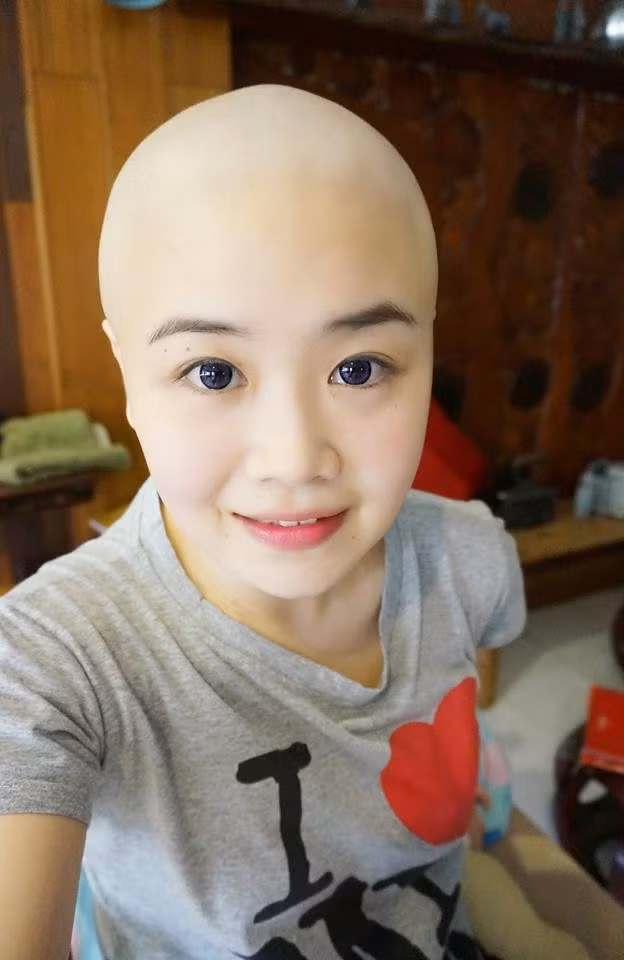 Chuyen la hom nay: Chong lam dieu nay... vo khoi luon ung thu-Hinh-2