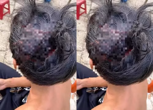 Tin nong ngay 28/9: Tai xe Vinasun va Mai Linh danh nhau be dau