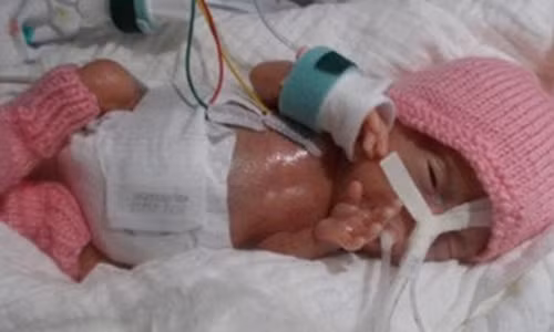 Theo sách kỷ lục thế giới Guinness, tháng 11/2017, Emilia Grabarczyk chào đời ở tuần thứ 26 tại bệnh viện St. Mary, thành phố Witten, Đức và trở thành em bé sinh non vẫn sống sót có cân nặng nhẹ nhất thế giới.