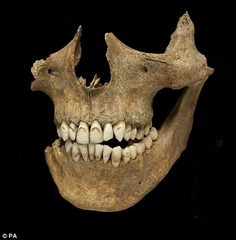 Các chuyên gia hy vọng việc làm này sẽ góp phần làm sáng tỏ nơi mà người lính trên từng đến cũng như tình trạng sức khỏe, có mắc căn bệnh nào hay không...