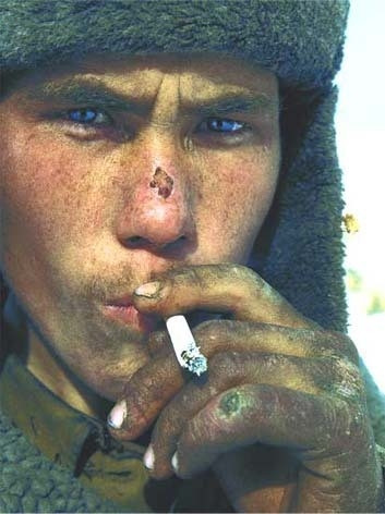 Nhiều binh lính Nga tới Chechnya làm nhiệm vụ khi tuổi đời còn khá trẻ.