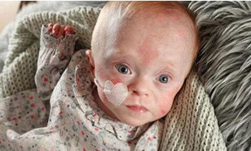 Khi sinh ra, Grabarczyk có chiều dài cơ thể là 22 cm, bàn chân dài 3 cm và cân nặng 226 gram.