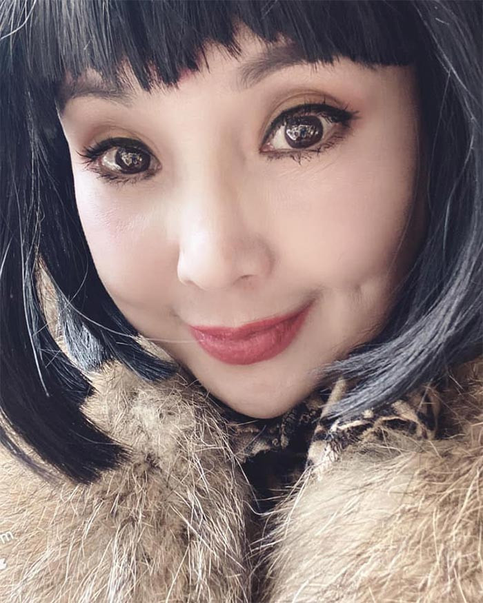 Ngoài ra, nữ nghệ sĩ chỉ một lần phẫu thuật hạ gò má.