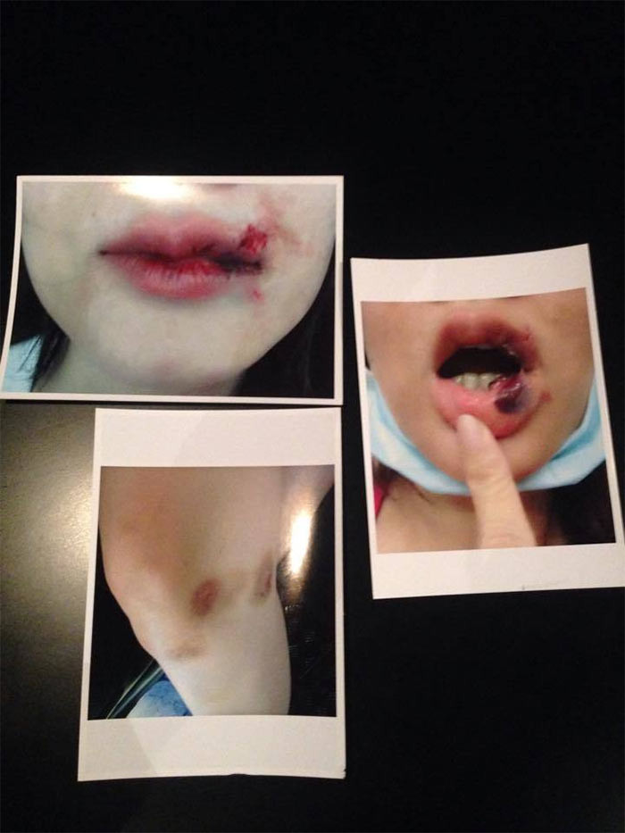 Năm 2015, Dương Yến Ngọc đã tố chồng thứ hai, doanh nhân Trần Thông đánh đập dù lúc đó cô vừa hoàn thành thủ tục ly hôn với người này. (Ảnh: Vietnamnet)