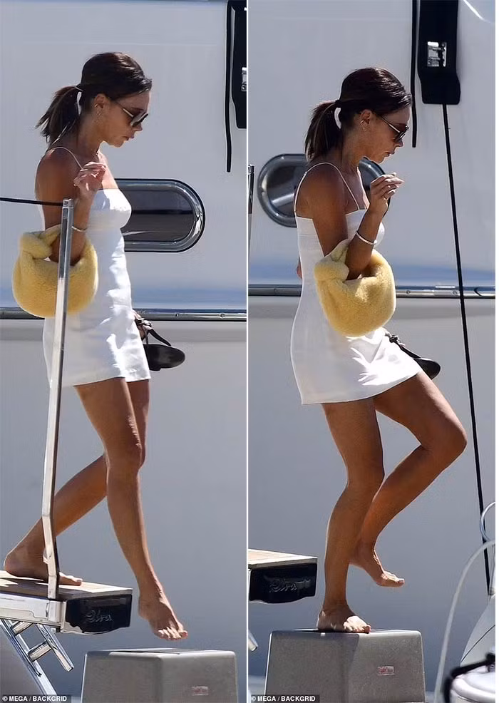 Không chỉ vùng da cổ mà phần da đầu gối cũng chùng nhão, tố cáo tuổi già của Victoria. (Ảnh: Mega)