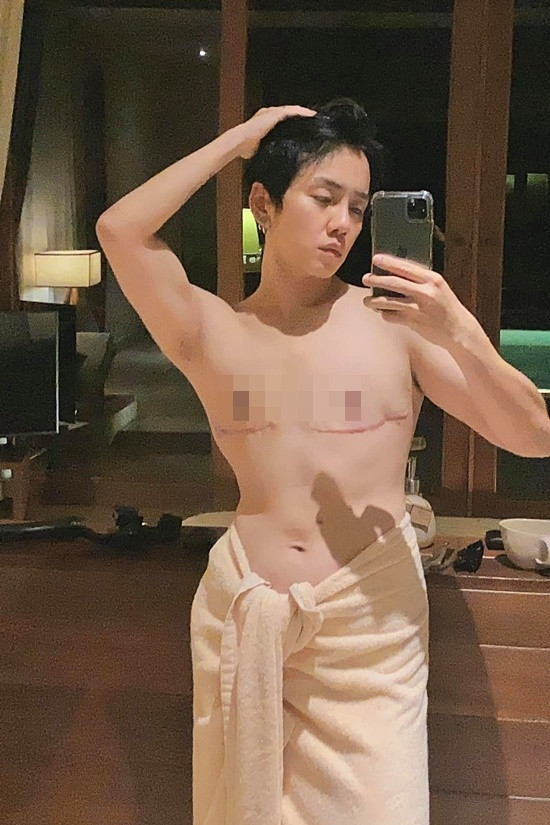 Tháng 10 năm ngoái, tình chuyển giới của Miko Lan Trinh còn gây chú ý khi quyết định phẫu thuật cắt ngực để sở hữu body như nam giới thực thụ.