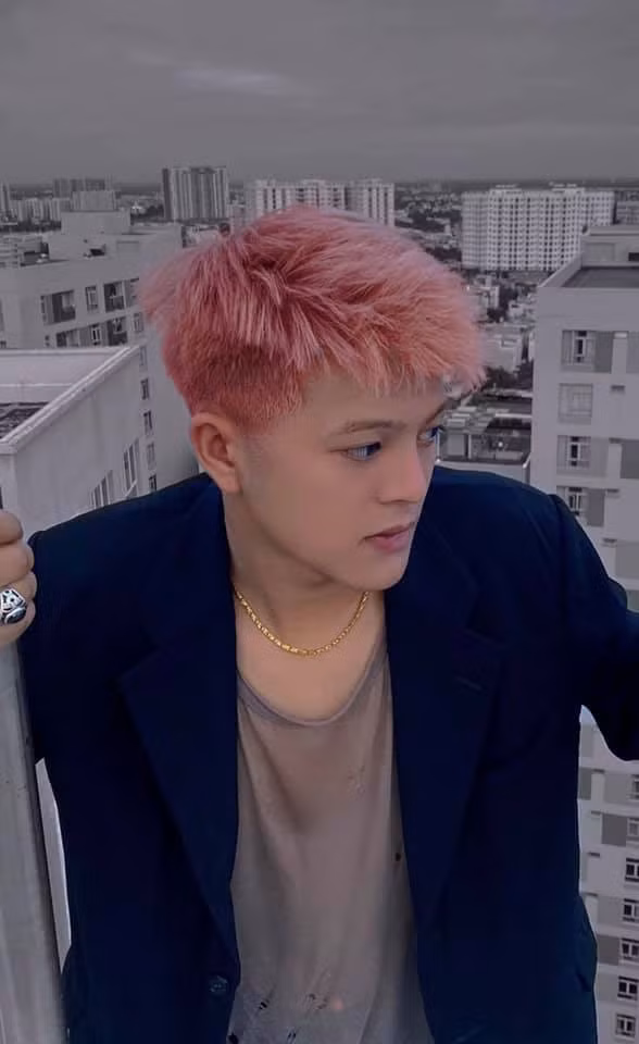 Sau khi phẫu thuật thẩm mỹ, khuôn mặt của Quang Anh đã thay đổi rất nhiều so với lúc mới đăng quang quán quân The Voice Kids 2013.