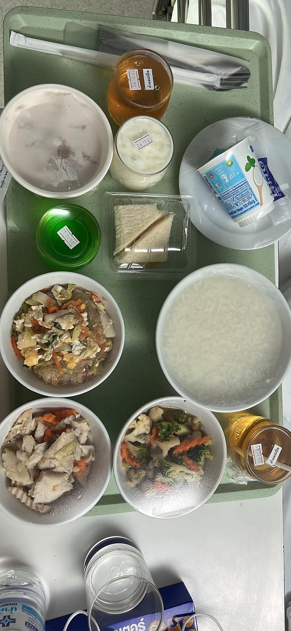 Khẩu phần ăn của Lâm Khánh Chi sau ca phẫu thuật. 