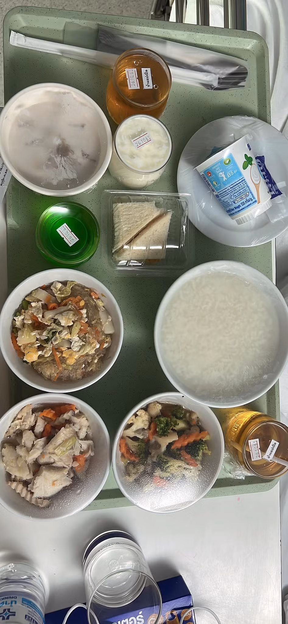 Khẩu phần ăn của Lâm Khánh Chi sau ca phẫu thuật. 