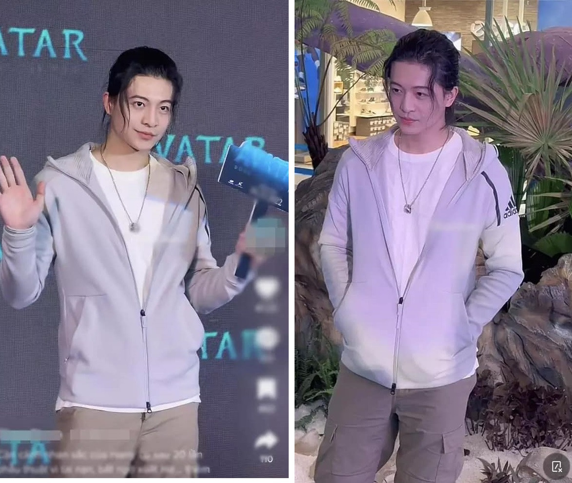 Gần đây, nam diễn viên sinh năm 1992 lần đầu tiên xuất hiện trước công chúng sau khi trở về Việt Nam tham dự sự kiện. Diện mạo mới của Harry Lu được fan ví von nhìn giống "Michael Jackson phiên bản da trắng". Ảnh: 2Sao.