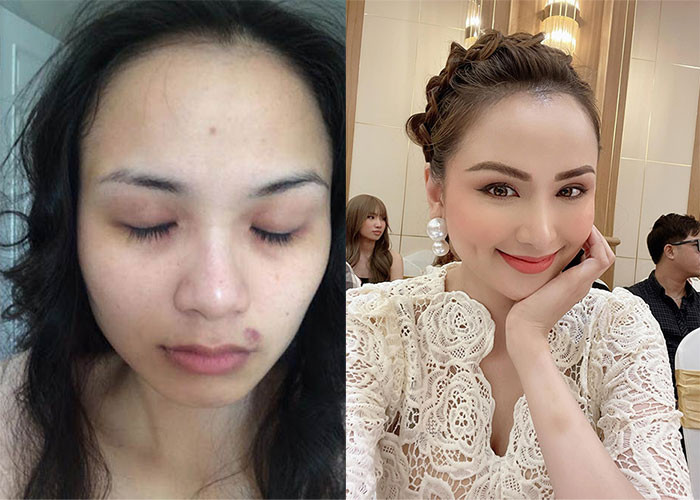 Năm 2014, Hoa hậu Diễm Hương công khai bị chồng đại gia đánh đập đến tím tái mặt mày. Theo Diễm Hương, sự việc đã kéo dài suốt 3 năm, khiến cô “sống không bằng chết”. Hiện Diễm Hương đã có cuộc sống mới. (Ảnh: FBNV, Phunuvietnam.vn)