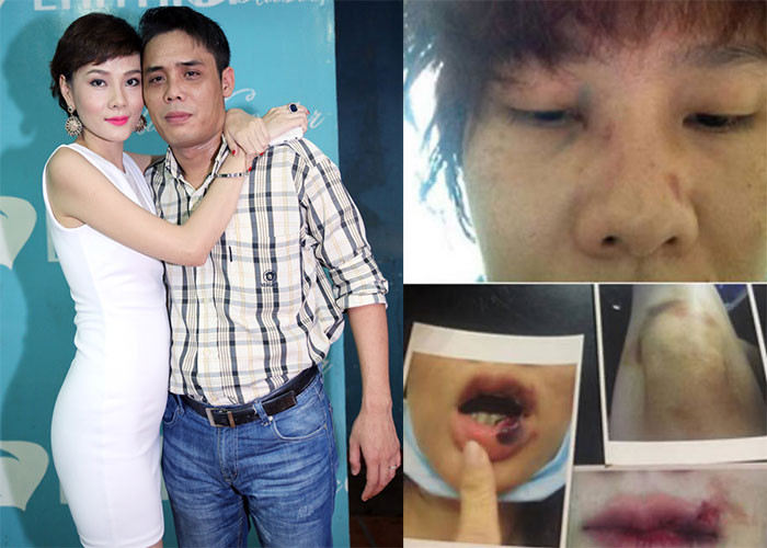 Tháng 9/2015, Á hậu Phụ nữ Việt Nam 2000 - Dương Yến Ngọc cho biết mình bị chồng doanh nhân Trần Thông đánh, gây thương tích nghiêm trọng. Theo chia sẻ của Dương Yến Ngọc, mỗi tuần cô bị đánh đến 2,3 lần và mỗi lần diễn ra đến 3,4 tiếng. Hiện cặp đôi đã ly hôn. (Ảnh: FBNV, Phunuvietnam.vn)