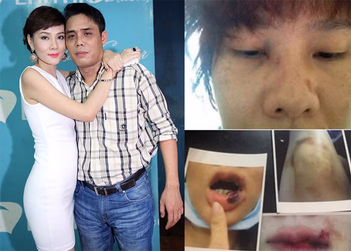 Tháng 9/2015, Á hậu Phụ nữ Việt Nam 2000 - Dương Yến Ngọc cho biết mình bị chồng doanh nhân Trần Thông đánh, gây thương tích nghiêm trọng. Theo chia sẻ của Dương Yến Ngọc, mỗi tuần cô bị đánh đến 2,3 lần và mỗi lần diễn ra đến 3,4 tiếng. Hiện cặp đôi đã ly hôn. (Ảnh: FBNV, Phunuvietnam.vn)