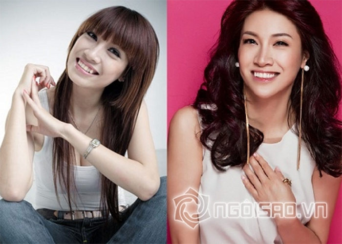 Năm 2017, Pha Lê từng thừa nhận chuyện dao kéo khuôn mặt. sửa lại mũi và răng. (Ảnh: ngoisao.vn)