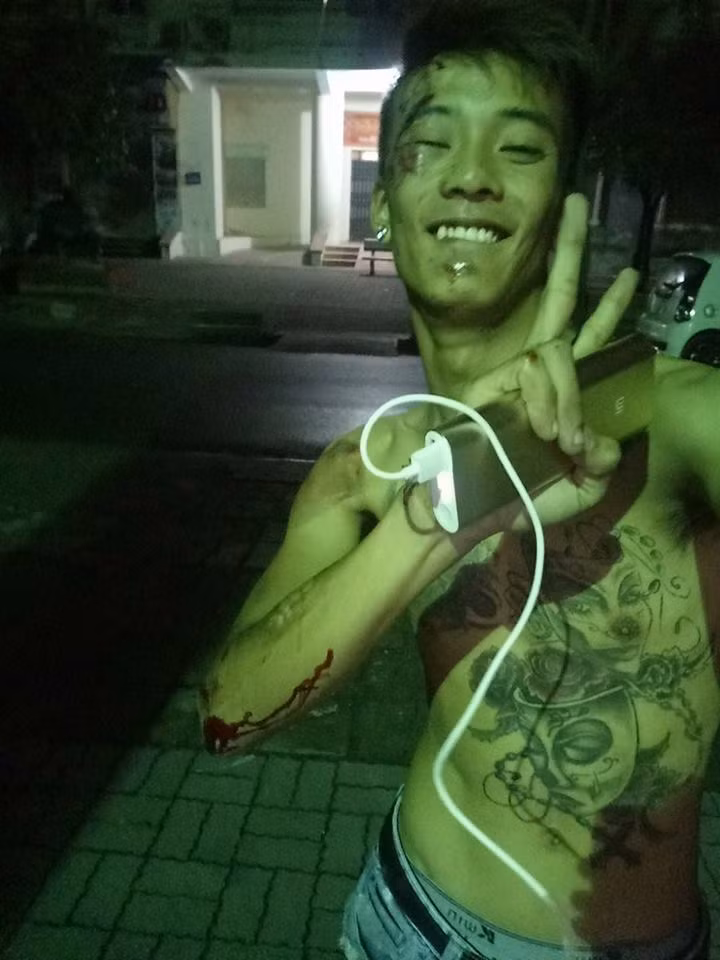 Bị chấn thương dẫn đến tử vong từ một vụ tai nạn giao thông, nhưng sau cú ngã đầu tiên, Đạt Cỏ vẫn đứng dậy, tươi cười selfie để bạn bè khỏi lo lắng. Nhưng rồi số phận bẽ bàng vẫn cướp đi mạng sống của chàng trai trẻ có tính tình hiền hậu và một con người đầy tài năng, đang đợi dịp để tỏa sáng thực sự này. Hôm nay tức 49 ngày mất của Đạt Cỏ... những người bạn của cậu, cư dân mạng và người thân vẫn không ngừng kể nhiều câu chuyện trước đây về chàng trai trẻ đoản mệnh và cùng cầu mong cho linh hồn cậu được siêu thoát, về một nơi yên bình, tốt đẹp hơn.