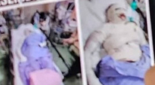 Cai va, chong tam xang thieu vo gay bang hoang