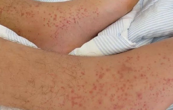 Thuc khuya lau ngay, co gai hoa “quai vat” khong dam soi guong