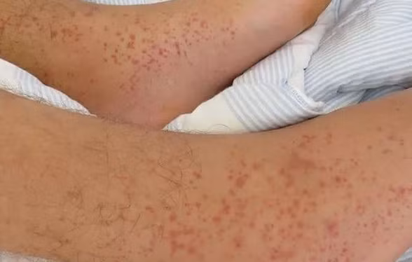 Thuc khuya lau ngay, co gai hoa “quai vat” khong dam soi guong