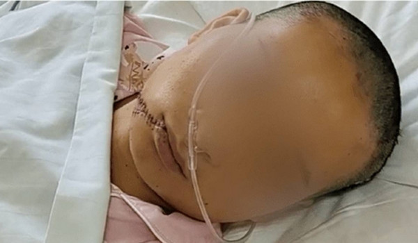 Vợ đệ đơn ly hôn, chồng trả thù dã man gây phẫn nộ Vo de don ly hon, chong tra thu da man gay phan no