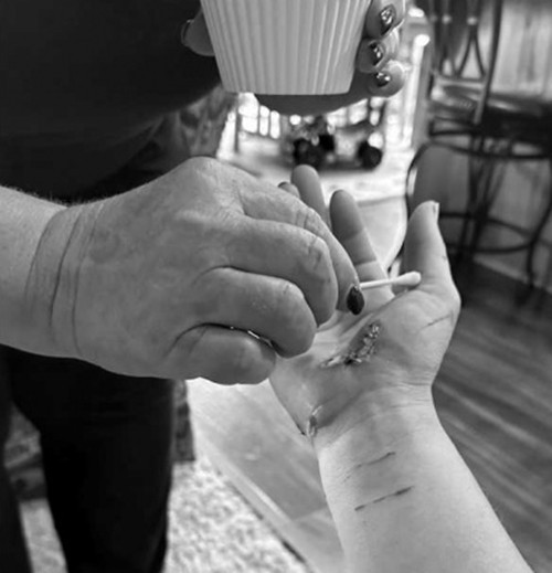 Ngay sau đó, Jen cũng bị rái cá cắn vào cánh tay, tai, bàn tay, chân và mắt cá chân trong khoảng 5 phút, khi cô cố gắng cứu bạn mình, con rái cái lại tiếp tục lao đến tấn công cô một cách điên cuồng.