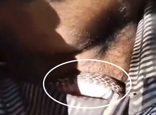 Trong đoạn video lan truyền trên mạng, người làm vườn đã giơ cao cả hai tay để tránh nguy hiểm, trong khi con rắn hổ mang thò đầu qua khoảng hở của các khuy áo.