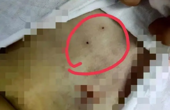 Tieng het tham phoi bay chuyen ghe ron trong phong phau thuat