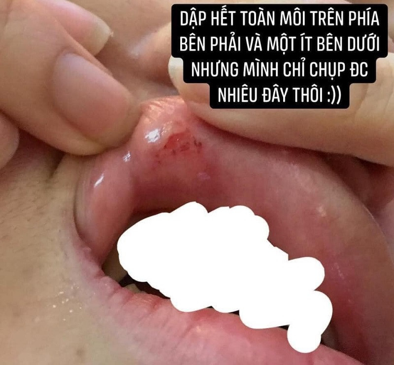 Trai la tha tim, co gai bi nguoi yeu danh gay buc xuc-Hinh-2