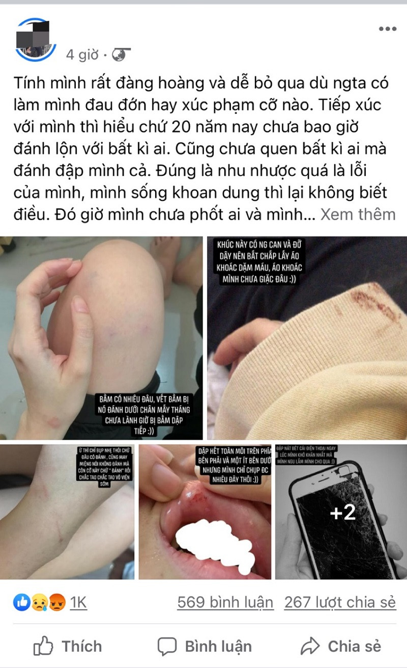 Trai la tha tim, co gai bi nguoi yeu danh gay buc xuc