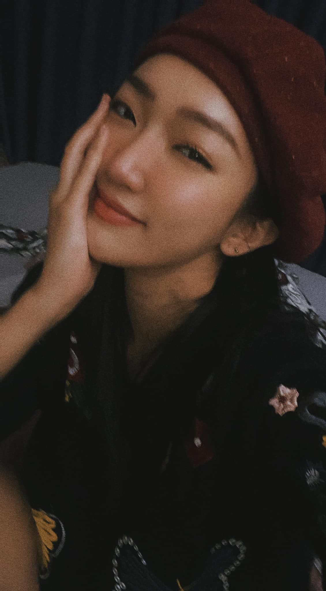 Linh Sugar từng công khai việc hạ xương gò má để có 1 khuôn mặt hài hoà hơn. Ngoài ra, cô nàng cũng dính một số tin đồn đã dao kéo phần mũi. Ảnh: FBNV