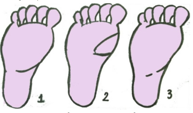 Dau hieu vang trong long ban chan hua hen se dap trung “kho bau” cua Than Tai-Hinh-2