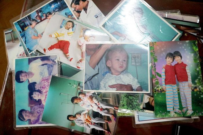 Cap song sinh Cuc - An sau 17 nam mo tach roi gio ra sao?-Hinh-2