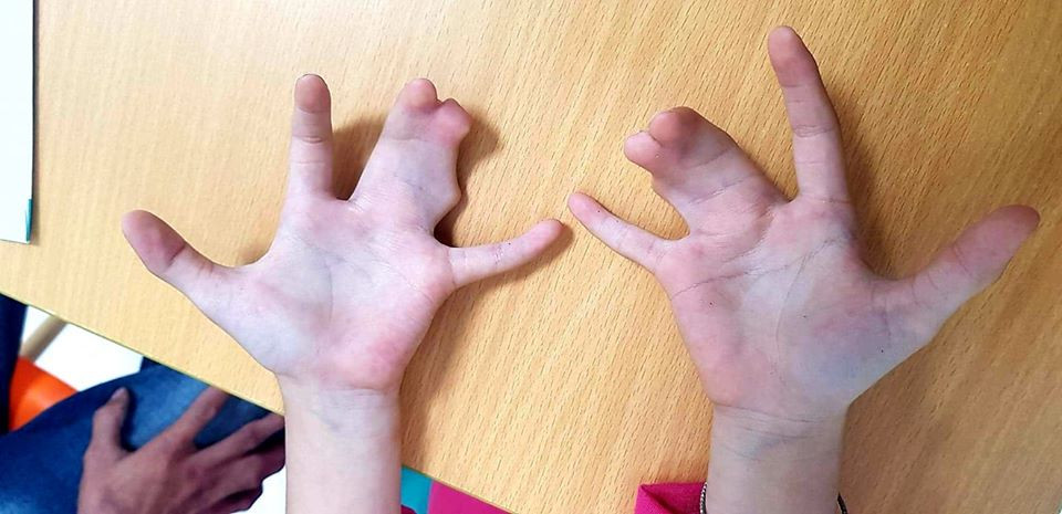 Tien Giang: Dong ho 4 doi bi di tat ban tay cang tom hum