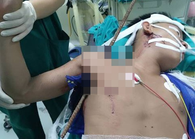 Cuu nam cong nhan bi thanh sat dam xuyen nach